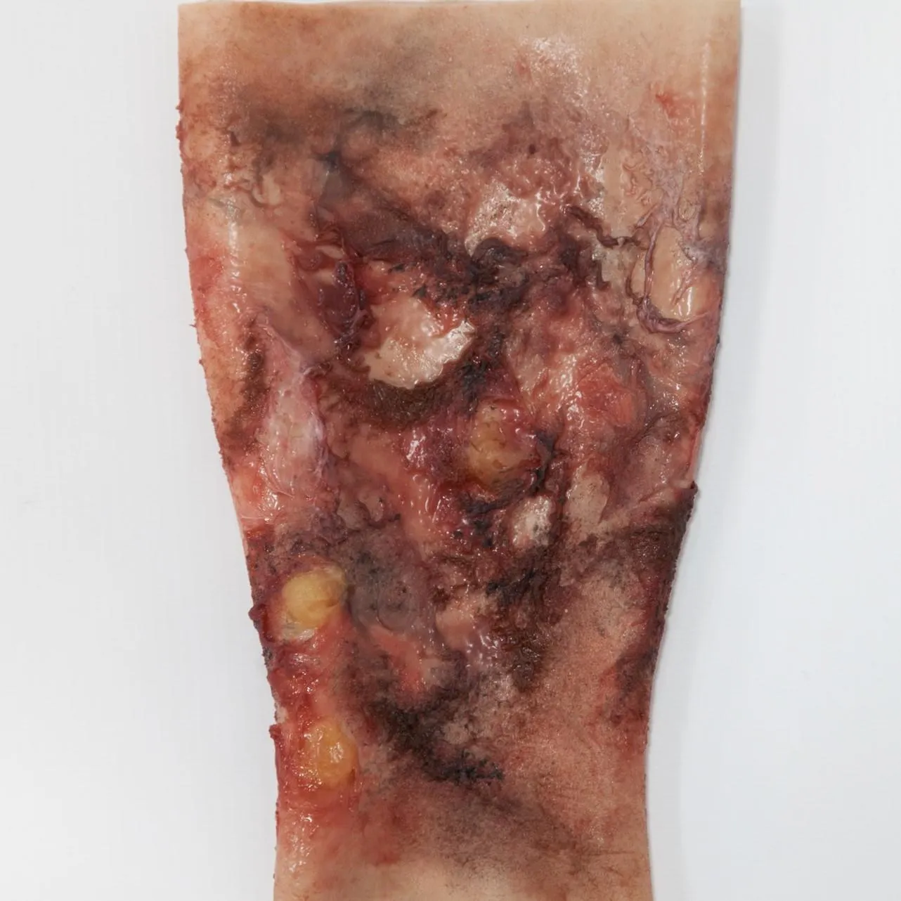 Water-Jel Simwound Essential Burns brannskadesett øving