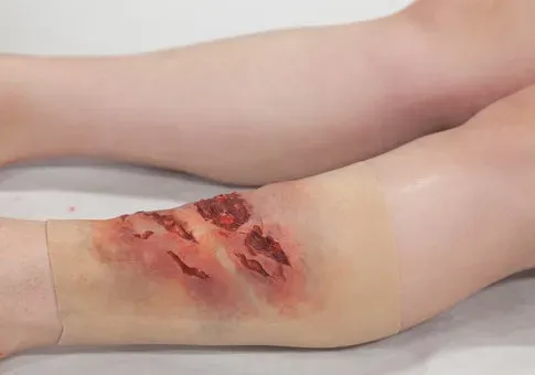 Water-Jel Leg Sleeves brannbandasje legg