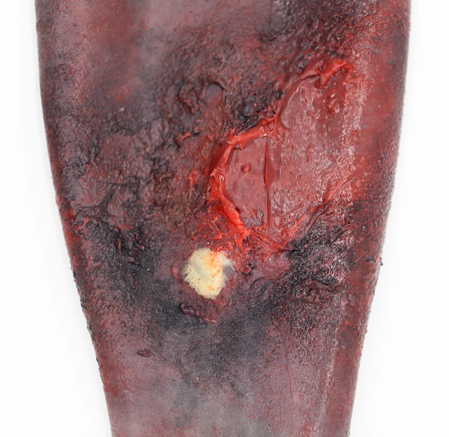 Water-Jel Simwound Essential Burns brannskadesett øving