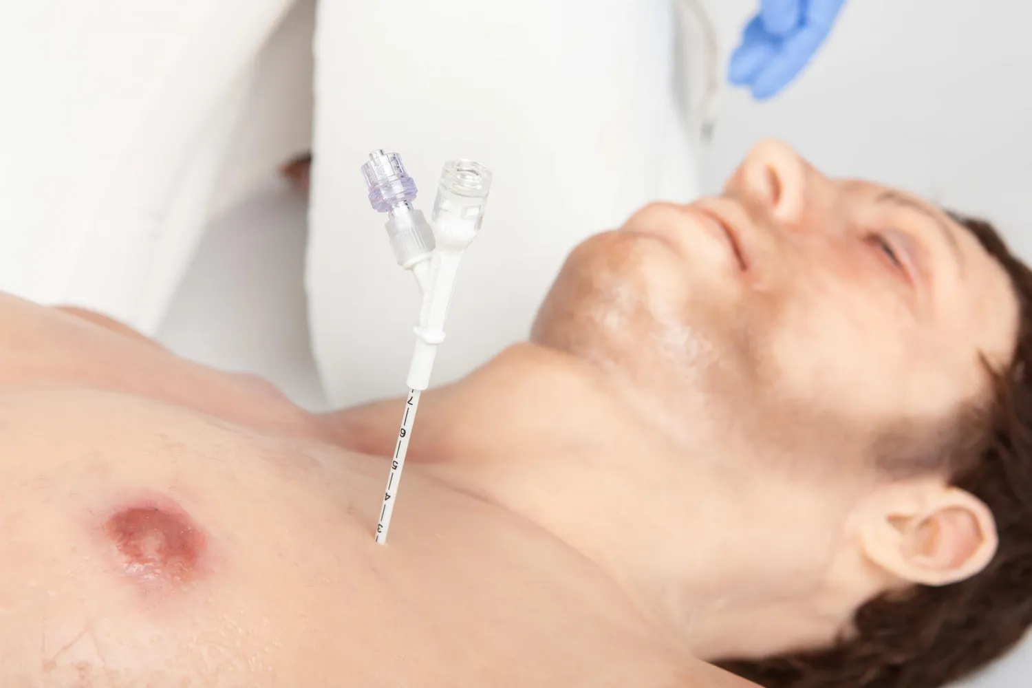 Russell Pneumofix brystplaster 8 cm ventilert brystskade